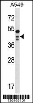 OBFC1 Antibody (C-term)