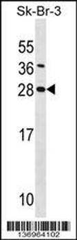 SDC4 Antibody (Center)