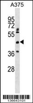ASPHD2 Antibody (Center)