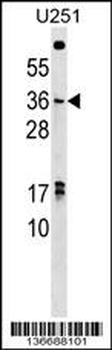 NKX3-1 Antibody (C-term)