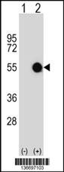 MKRN2 Antibody (N-term)