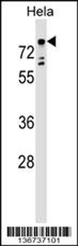 TBX2 Antibody (Center)