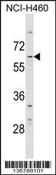 DCP1A Antibody (N-term)