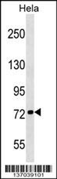 KIF3B Antibody (N-term)