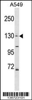 COL4A6 Antibody (Center)