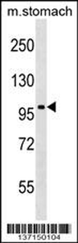 Mouse Taok3 Antibody (N-term)
