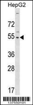 GLTSCR2 Antibody (C-term)