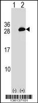 UBE2T Antibody (C-term)