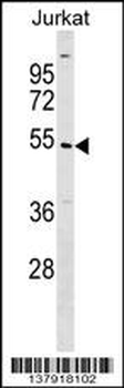 UBE2Q1 Antibody (N-term)