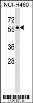 TYRP1 Antibody (Center)