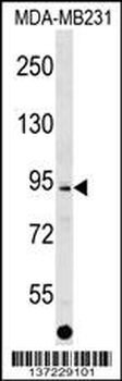 ALS2CL Antibody (Center)