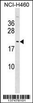 TTDN1 Antibody (C-term)