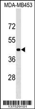 GRSF1 Antibody (Center)