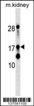 DR1 Antibody (Center)