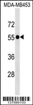SCLY Antibody (N-term)