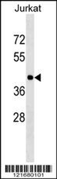 HLA-C Antibody (Center)