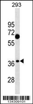 C1QTNF7 Antibody (N-term)