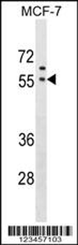 GORASP1 Antibody (Center)