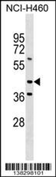 MEIS3 Antibody (Center)
