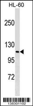 MPHOSPH9 Antibody (N-term)