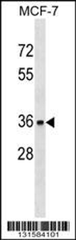 TOR1A Antibody (C-term)