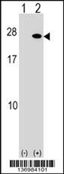 FGF19 Antibody (C-term)