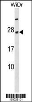 TGIF2LY Antibody (N-term)