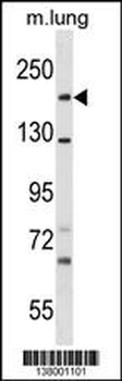 SNED1 Antibody (N-term)