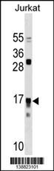 IL17RC Antibody (N-term)