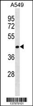 RCOR2 Antibody (Center)