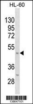 Mouse Kcnj11 Antibody (N-term)