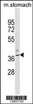 Mouse Kcnj11 Antibody (N-term)