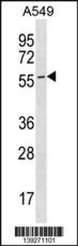 ESAM Antibody (C-term)