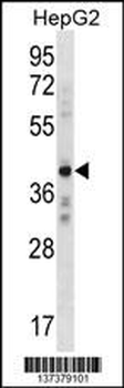 AEBP2 Antibody (C-term)