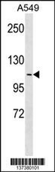 APOB48R Antibody (Center)