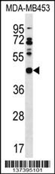 DNAJB5 Antibody (C-term)