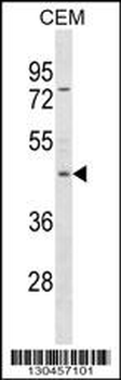 FOXP3 Antibody (C-term S418)