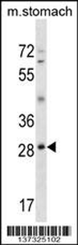 GSC Antibody (N-term)