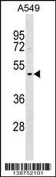 DNASE1L1 Antibody (Center)