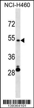 IRX6 Antibody (Center)