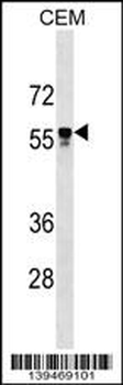 API5 Antibody (C-term)