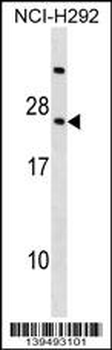 RARRES3 Antibody (Center)
