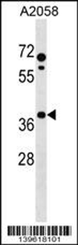 PHLDA1 Antibody (N-term)