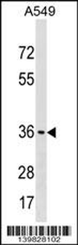 ART5 Antibody (Center)