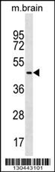 FAF2 Antibody (C-term)