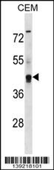 KCNG2 Antibody (Center)