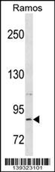 RXFP2 Antibody (C-term)