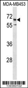 CATSPER2 Antibody (C-term)