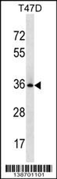 BCL2L12 Antibody (N-term)