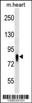 UBASH3A Antibody (Center)